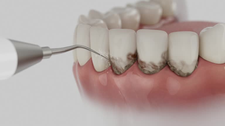Reliable Dental contractor in Bainbridge Island, WA by Dentist Open Now